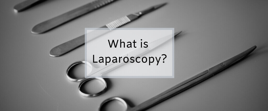 What is Laparoscopy, or Laparoscopic Surgery, for Pets? 